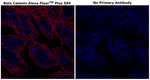 beta Catenin Antibody in Immunohistochemistry (Paraffin) (IHC (P))