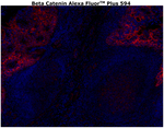 beta Catenin Antibody in Immunohistochemistry (Paraffin) (IHC (P))
