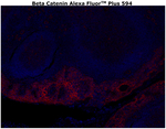 beta Catenin Antibody in Immunohistochemistry (Paraffin) (IHC (P))