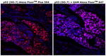 p53 Antibody in Immunohistochemistry (Paraffin) (IHC (P))