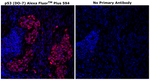 p53 Antibody in Immunohistochemistry (Paraffin) (IHC (P))