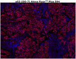 p53 Antibody in Immunohistochemistry (Paraffin) (IHC (P))