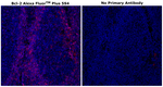 Bcl-2 Antibody in Immunohistochemistry (Paraffin) (IHC (P))
