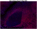Bcl-2 Antibody in Immunohistochemistry (Paraffin) (IHC (P))