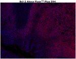 Bcl-2 Antibody in Immunohistochemistry (Paraffin) (IHC (P))
