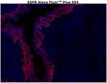 EGFR Antibody in Immunohistochemistry (Paraffin) (IHC (P))