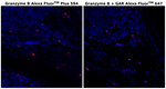 Granzyme B Antibody in Immunohistochemistry (Paraffin) (IHC (P))
