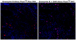 Granzyme B Antibody in Immunohistochemistry (Paraffin) (IHC (P))
