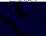 Granzyme B Antibody in Immunohistochemistry (Paraffin) (IHC (P))