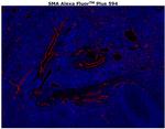 Alpha-Smooth Muscle Actin Antibody in Immunohistochemistry (Paraffin) (IHC (P))