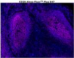 CD20 Antibody in Immunohistochemistry (Paraffin) (IHC (P))