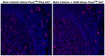 beta Catenin Antibody in Immunohistochemistry (Paraffin) (IHC (P))