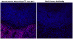 beta Catenin Antibody in Immunohistochemistry (Paraffin) (IHC (P))
