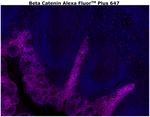 beta Catenin Antibody in Immunohistochemistry (Paraffin) (IHC (P))
