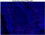FOXP3 Antibody in Immunohistochemistry (Paraffin) (IHC (P))