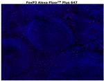 FOXP3 Antibody in Immunohistochemistry (Paraffin) (IHC (P))