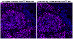 p53 Antibody in Immunohistochemistry (Paraffin) (IHC (P))