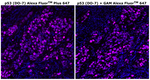 p53 Antibody in Immunohistochemistry (Paraffin) (IHC (P))