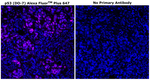 p53 Antibody in Immunohistochemistry (Paraffin) (IHC (P))