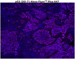 p53 Antibody in Immunohistochemistry (Paraffin) (IHC (P))