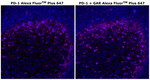 PD-1 (CD279) Antibody in Immunohistochemistry (Paraffin) (IHC (P))
