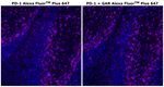 PD-1 (CD279) Antibody in Immunohistochemistry (Paraffin) (IHC (P))