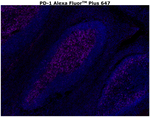 PD-1 (CD279) Antibody in Immunohistochemistry (Paraffin) (IHC (P))