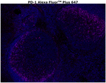 PD-1 (CD279) Antibody in Immunohistochemistry (Paraffin) (IHC (P))