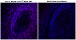 Bcl-2 Antibody in Immunohistochemistry (Paraffin) (IHC (P))