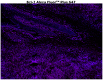 Bcl-2 Antibody in Immunohistochemistry (Paraffin) (IHC (P))