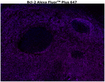 Bcl-2 Antibody in Immunohistochemistry (Paraffin) (IHC (P))
