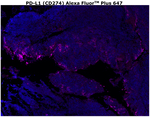 PD-L1 (CD274) Antibody in Immunohistochemistry (Paraffin) (IHC (P))