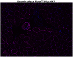 Desmin Antibody in Immunohistochemistry (Paraffin) (IHC (P))
