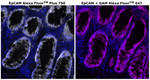 CD326 (EpCAM) Antibody in Immunohistochemistry (Paraffin) (IHC (P))