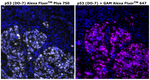 p53 Antibody in Immunohistochemistry (Paraffin) (IHC (P))