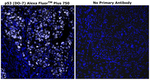 p53 Antibody in Immunohistochemistry (Paraffin) (IHC (P))