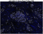 p53 Antibody in Immunohistochemistry (Paraffin) (IHC (P))