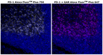 PD-1 (CD279) Antibody in Immunohistochemistry (Paraffin) (IHC (P))