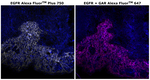 EGFR Antibody in Immunohistochemistry (Paraffin) (IHC (P))