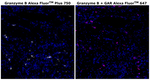 Granzyme B Antibody in Immunohistochemistry (Paraffin) (IHC (P))