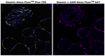 Desmin Antibody in Immunohistochemistry (Paraffin) (IHC (P))
