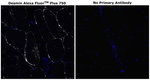 Desmin Antibody in Immunohistochemistry (Paraffin) (IHC (P))