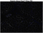Desmin Antibody in Immunohistochemistry (Paraffin) (IHC (P))