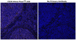 CD20 Antibody in Immunohistochemistry (Paraffin) (IHC (P))