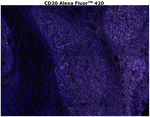 CD20 Antibody in Immunohistochemistry (Paraffin) (IHC (P))