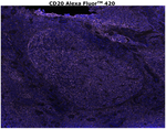 CD20 Antibody in Immunohistochemistry (Paraffin) (IHC (P))