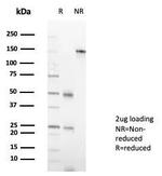 MZF1 (Transcriptional Corepressor) Antibody in SDS-PAGE (SDS-PAGE)