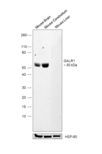 GALR1 Antibody in Western Blot (WB)