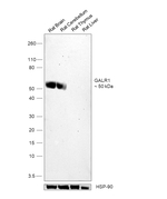 GALR1 Antibody in Western Blot (WB)