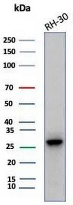 Carbonic Anhydrase 3/CA3 Antibody in Western Blot (WB)